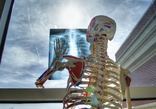 skeleton, medical, technology-2561573.jpg